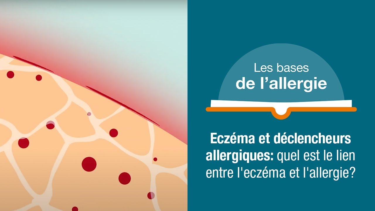 Eczéma et déclencheurs allergiques: quel est le lien entre l'eczéma et l'allergie? | Allergy Insider