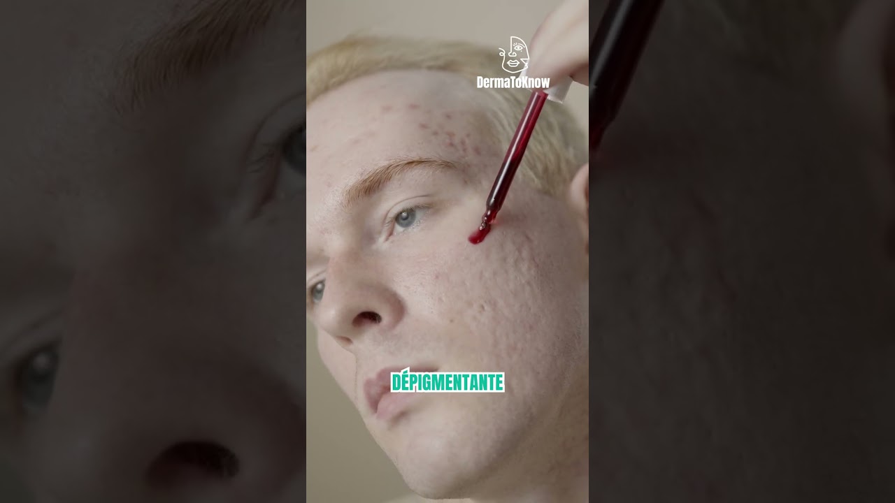 Comment atténuer de vieilles cicatrices ? 👉 Retrouvez-moi sur Instagram