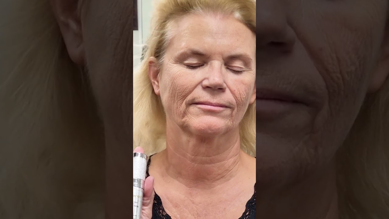 Quand les rides/poches disparaissent à vue d'oeil - jouvessence.fr  - Sérum à effet immédiat 3 min.