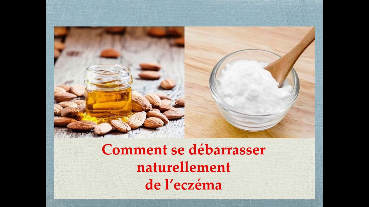 Soigner l'eczéma naturellement
