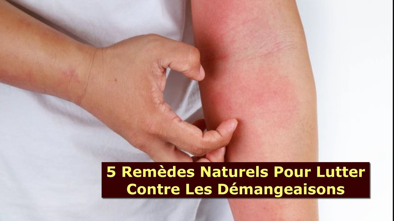 5 Remèdes Naturels Pour Lutter Contre Les Démangeaisons