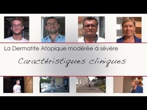 Dermatite atopique : caractéristiques cliniques