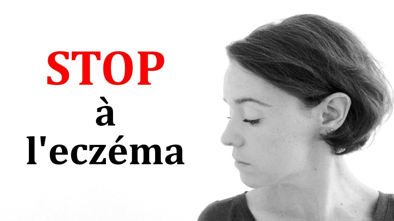 10 CONSEILS contre l'ECZÉMA et les problèmes de peau [ Traitement naturel ]