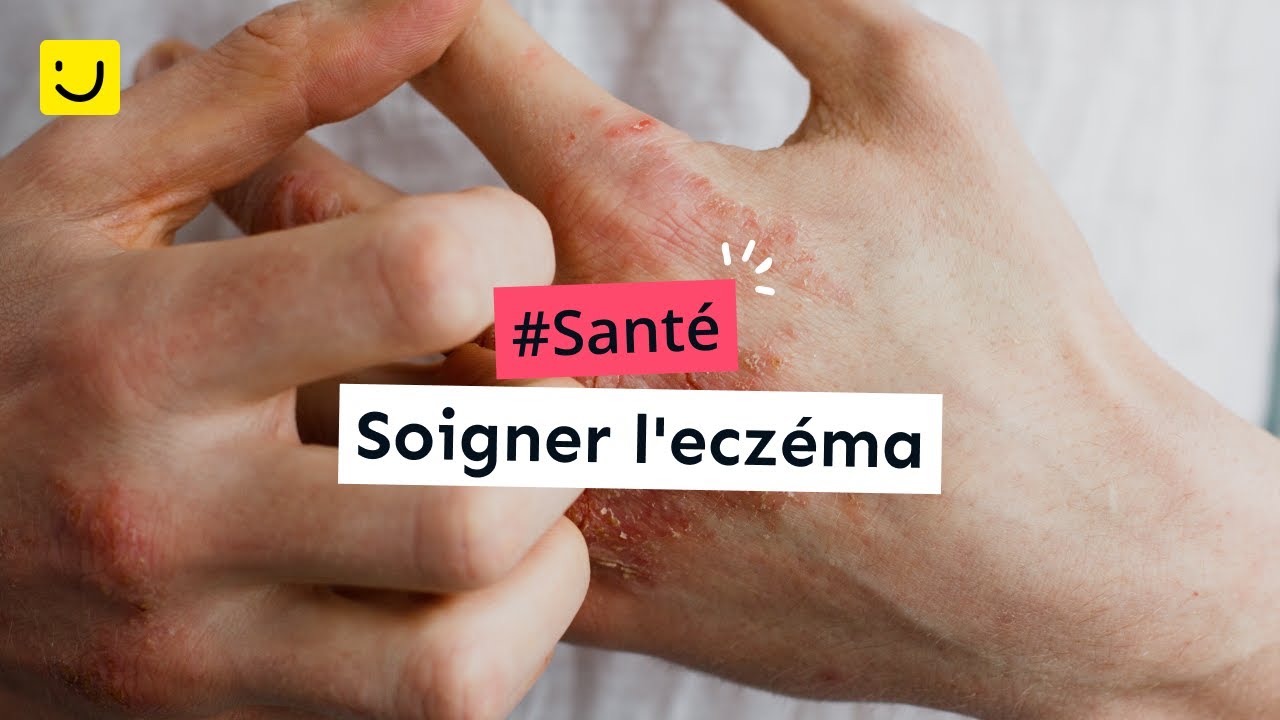 Soigner l'eczéma