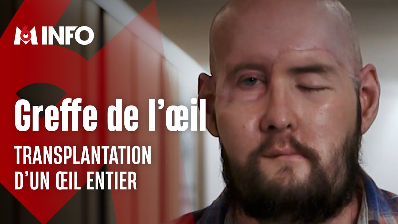 La première greffe de l'œil au monde