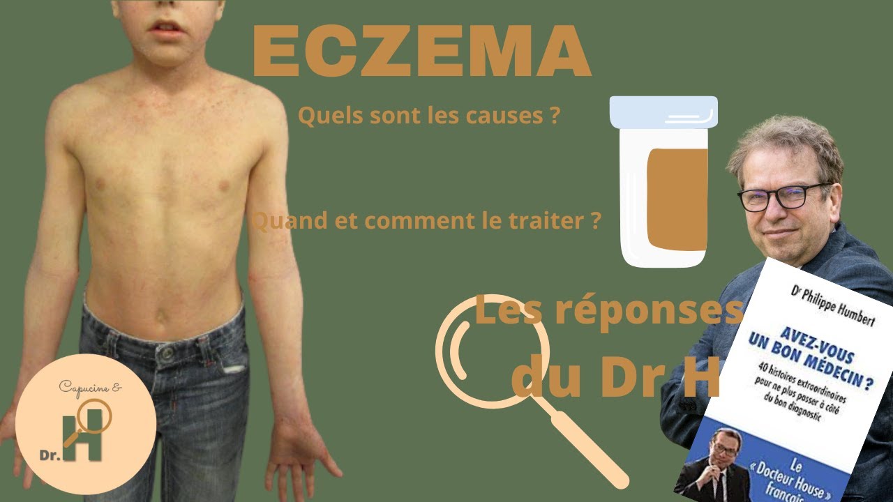 Qu'est-ce que l'eczéma ? Comment le traiter ?