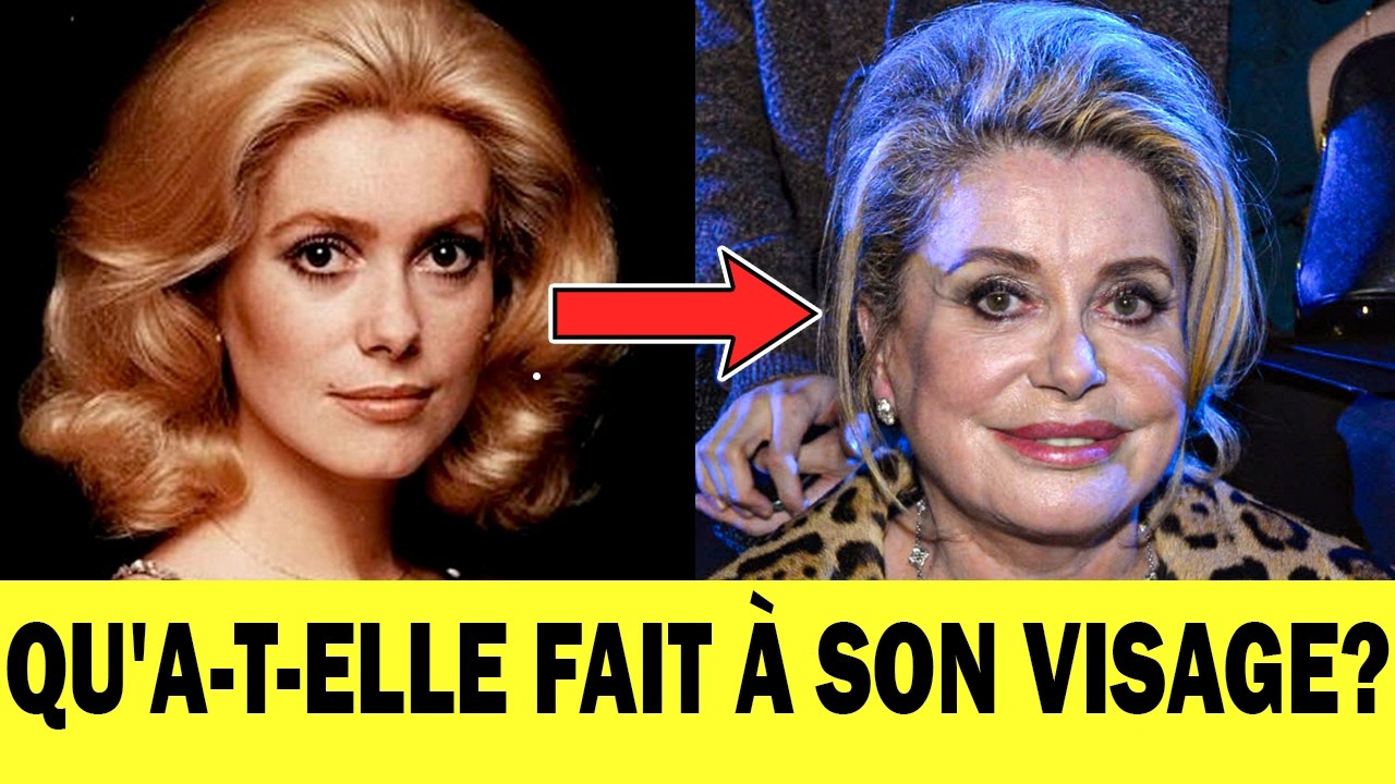 Avant et après : comment la CHIRURGIE ESTHÉTIQUE a défiguré le visage de 11 CÉLÉBRITÉS FRANÇAISES?