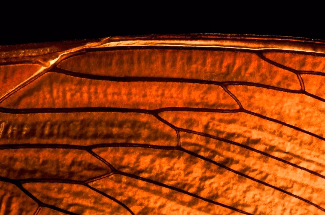 Photos d&rsquo;eczéma : à quoi ressemblent les différentes formes